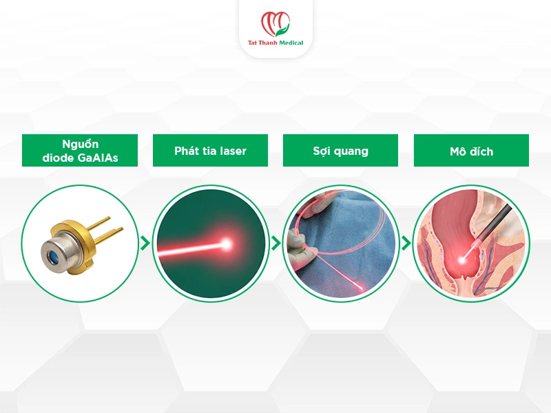 Máy Diode Laser Harlas: Công nghệ GaAlAs và các ứng dụng trong can thiệp laser